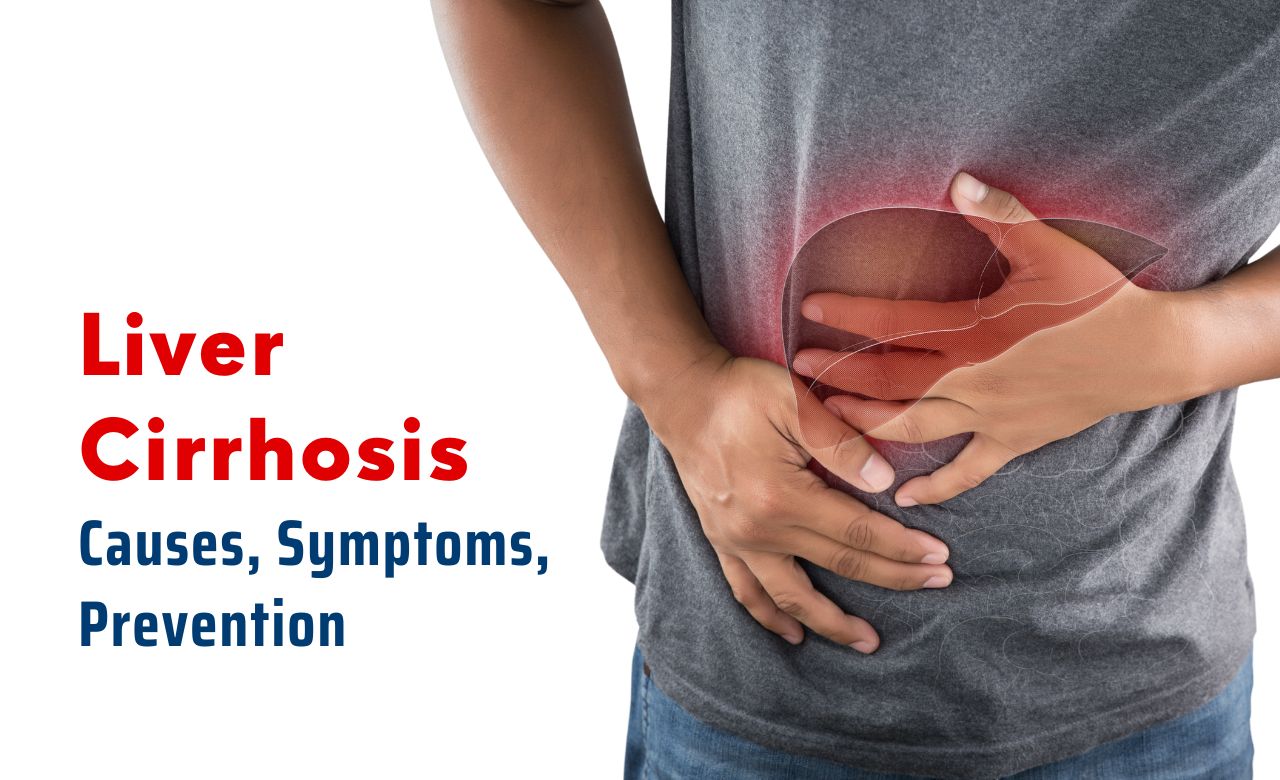 Liver Cirrhosis Causes Symptoms Prevention